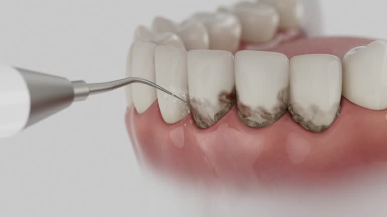 Reliable Emergency Dentist contractor in Perryville, MO by Smile Center Dentistry